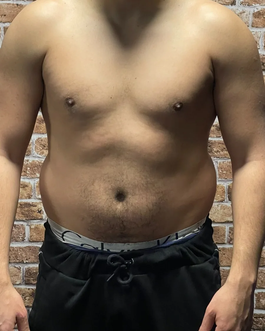 Nabil avant le programme, 89 kg : photo de face, torse.